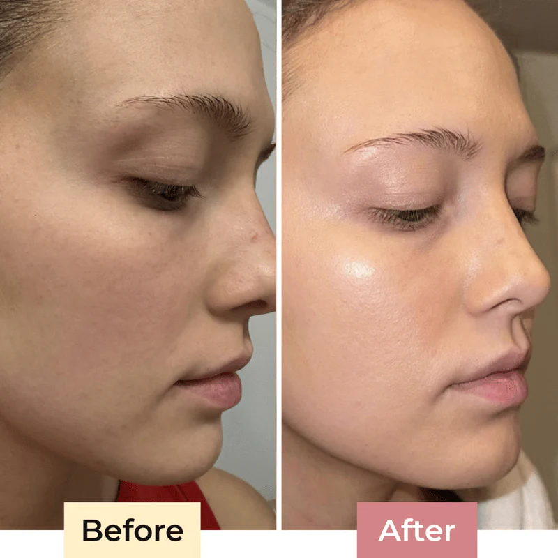 The SolaraShield - Protect Your Skin, Perfect Your Makeup - 50% OFF - Image 11